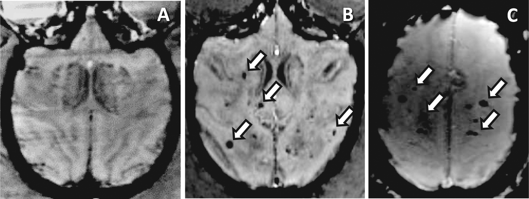 FIG. 1.