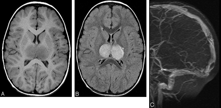 Fig 1.