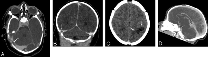 Fig 2.