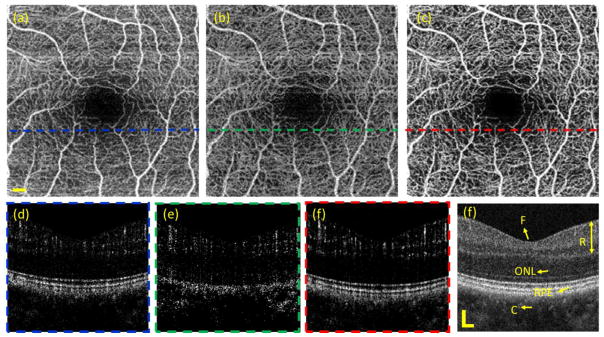 Fig. 9