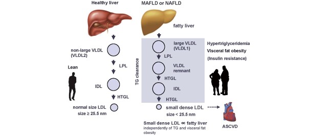 Fig.1. Association between MAFLD/NAFLD, sdLDL-C, and ASCVD