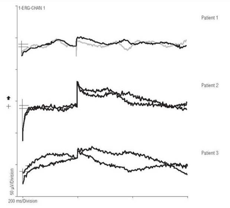 FIGURE 3