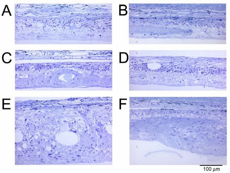 FIGURE 25