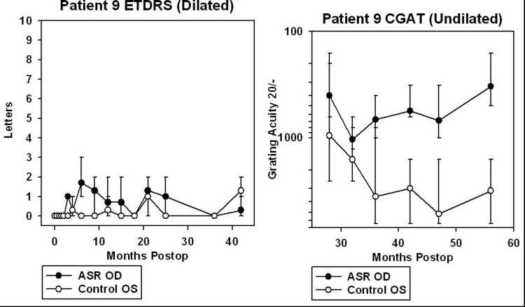 FIGURE 33