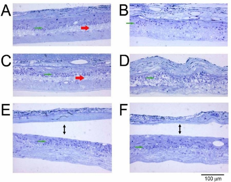 FIGURE 21