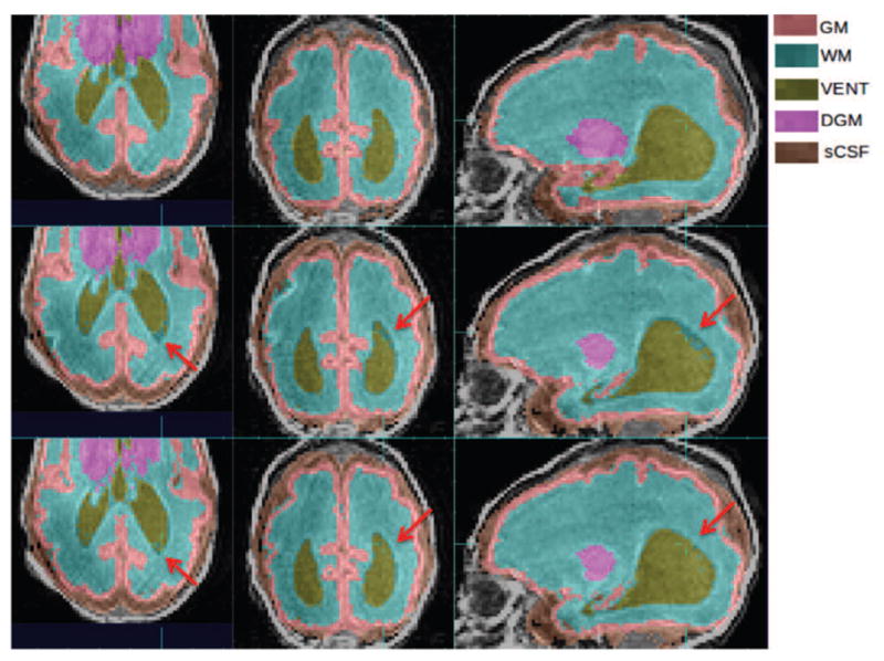 Figure 14