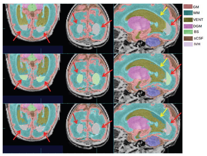 Figure 22