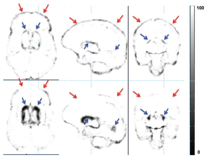 Figure 11