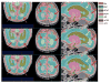 Figure 22