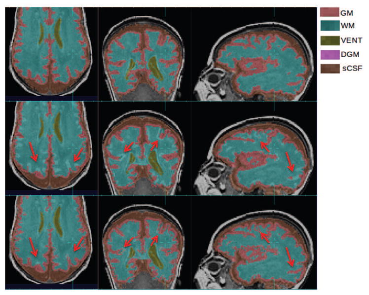 Figure 13