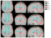 Figure 20