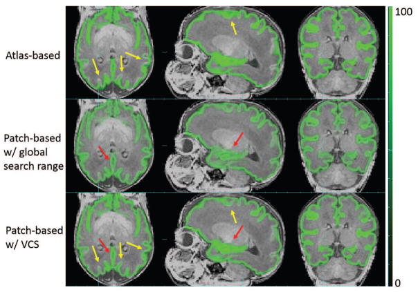 Figure 18