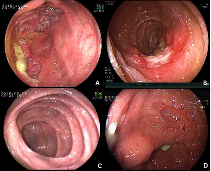 Fig. 1