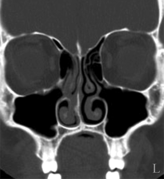 Fig. 4