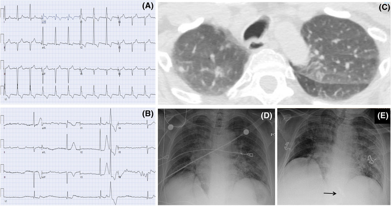 FIGURE 1