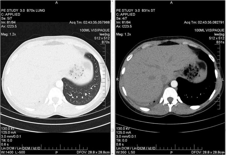 Fig 3