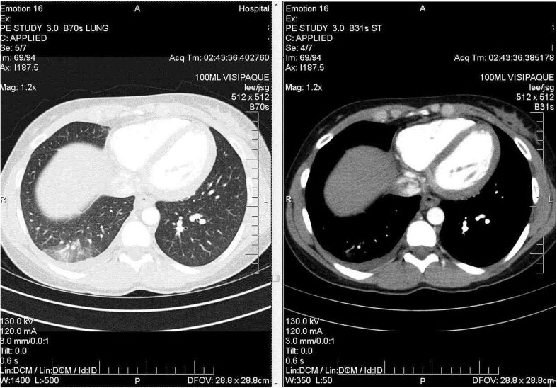 Fig 2