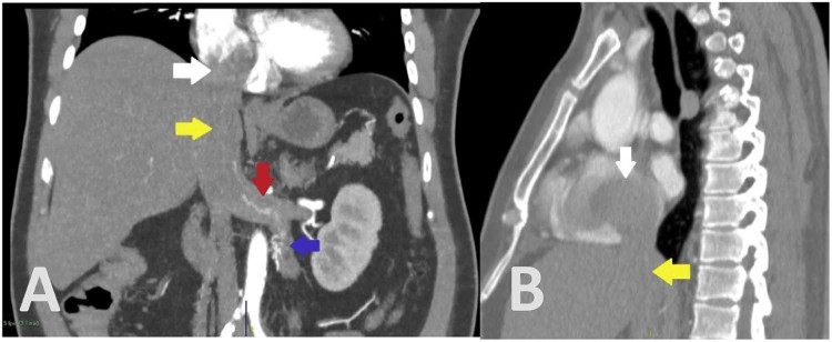 Fig. 2