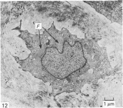 Fig. 12