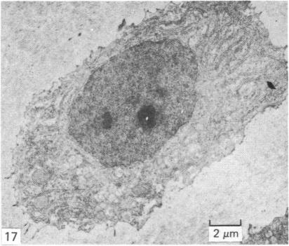 Fig. 17