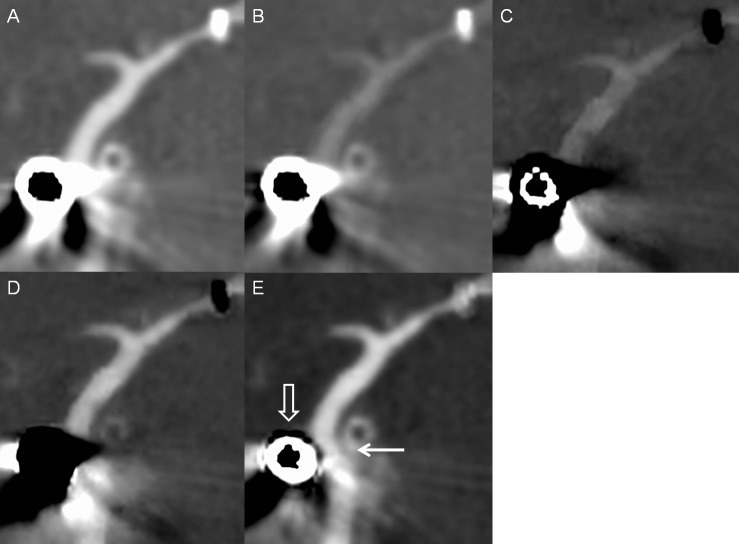 Fig 6