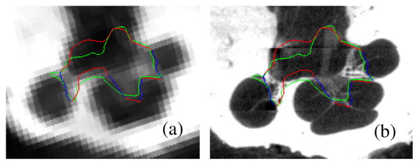 Fig. 4