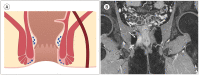 Fig. 11