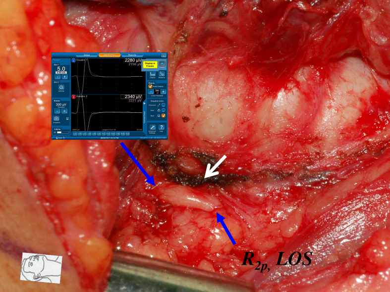 Figure 6