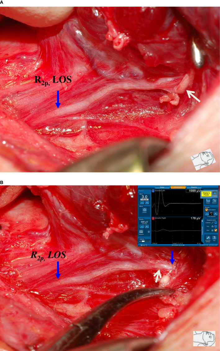 Figure 2