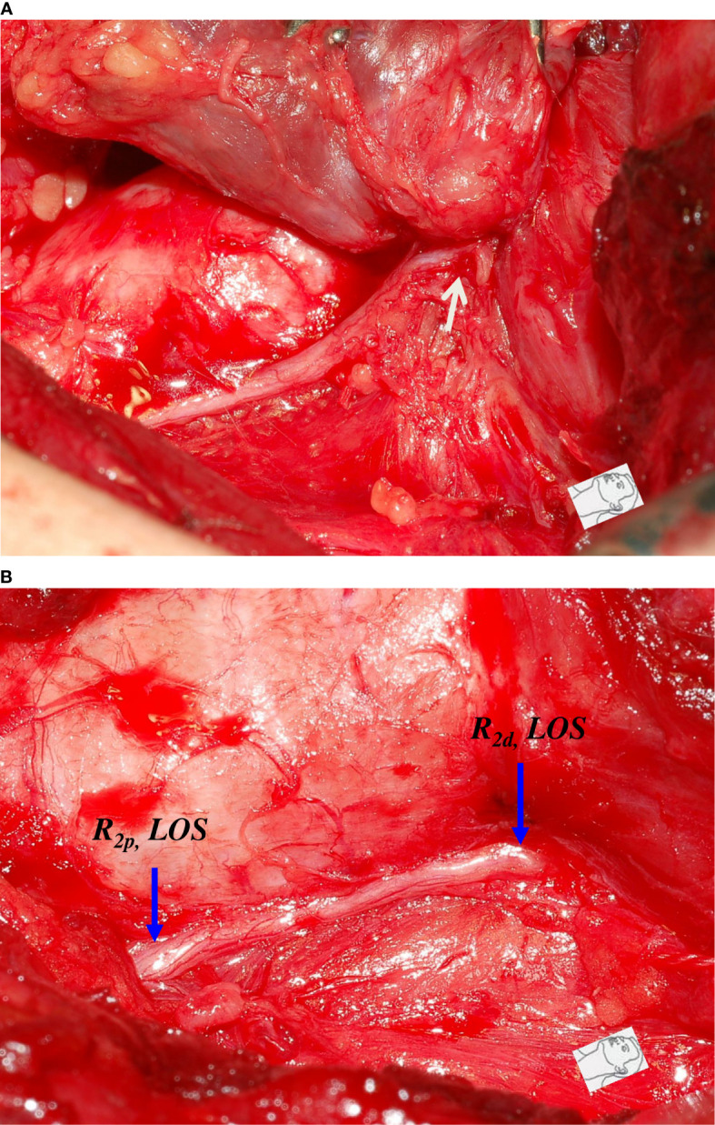 Figure 3