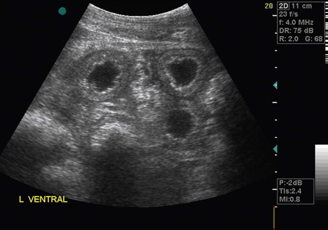 Figure 3.9