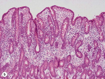 Figure 3.10