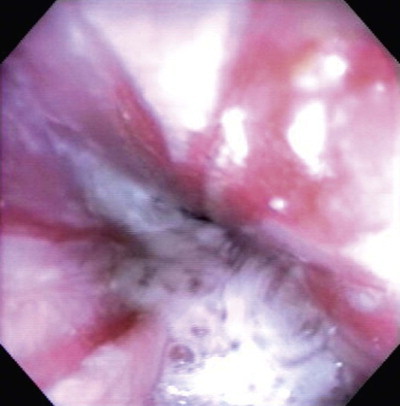 Figure 3.5