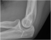 Fig. 9