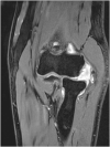 Fig. 11