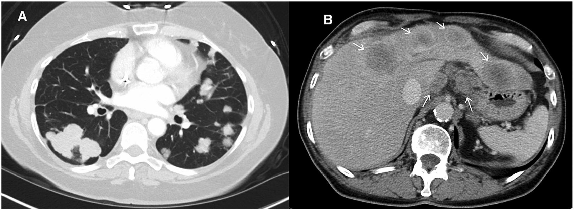 Fig. 5.