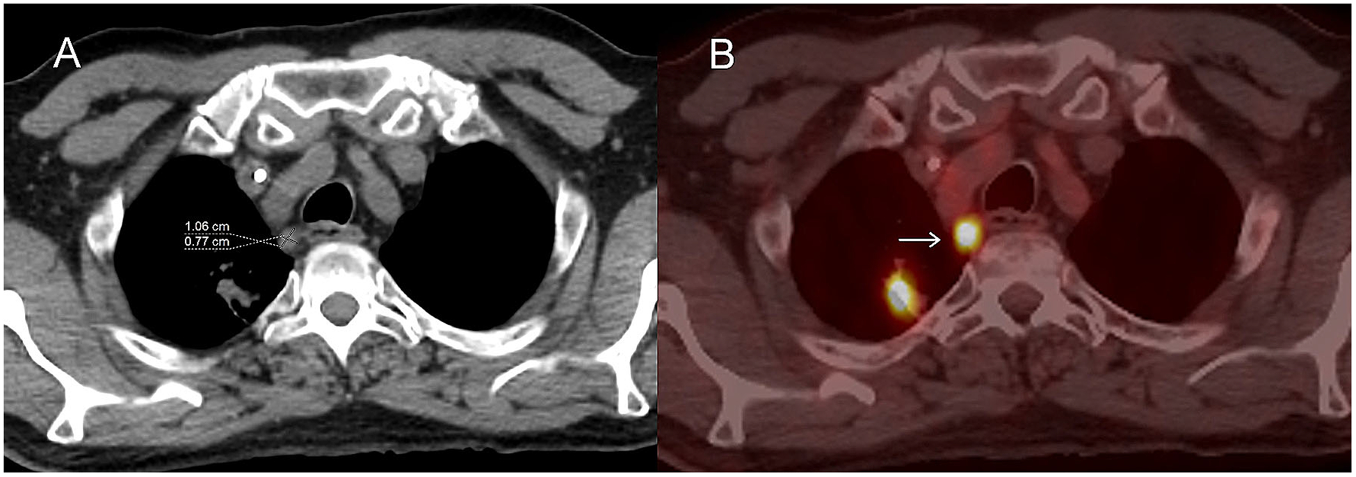 Fig. 6.