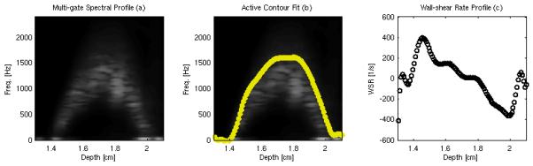 FIG. 3