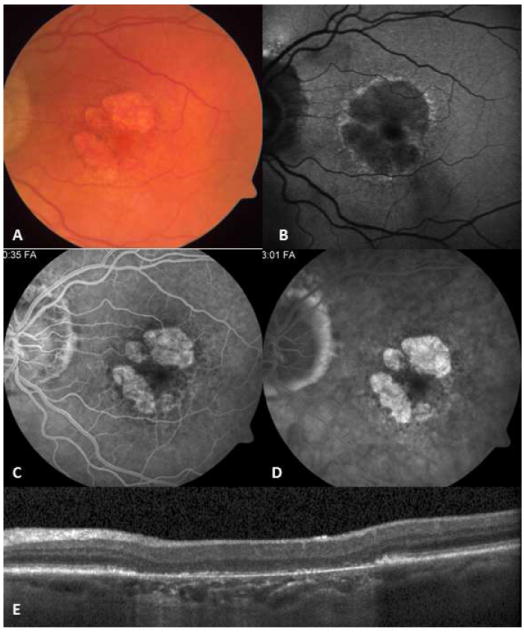 Figure 12