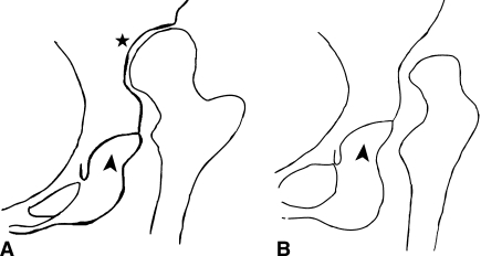 Fig. 5A–B