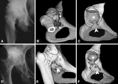 Fig. 4A–F