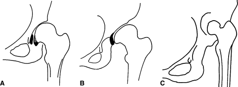 Fig. 1A–C