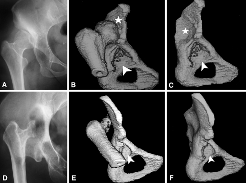 Fig. 6A–F