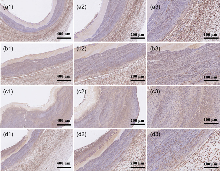 Fig. 14