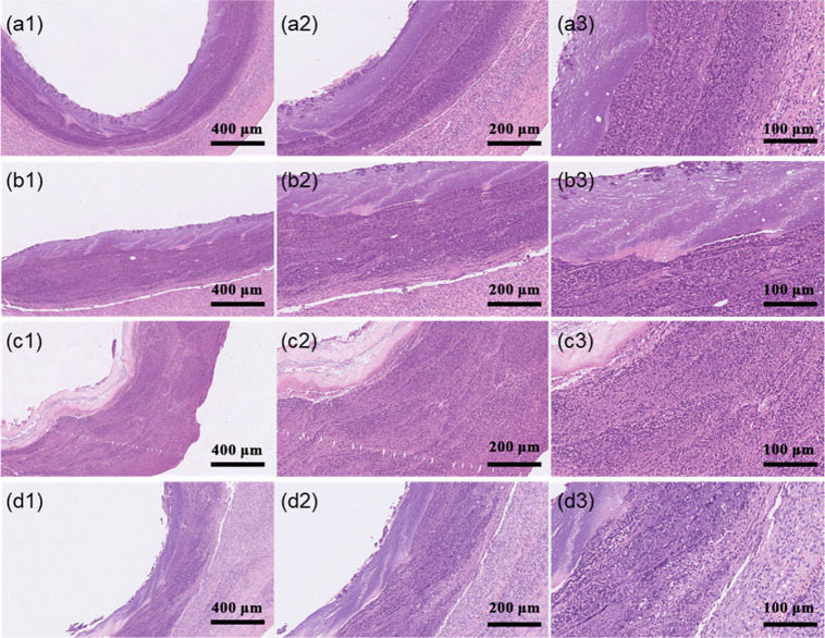 Fig. 13