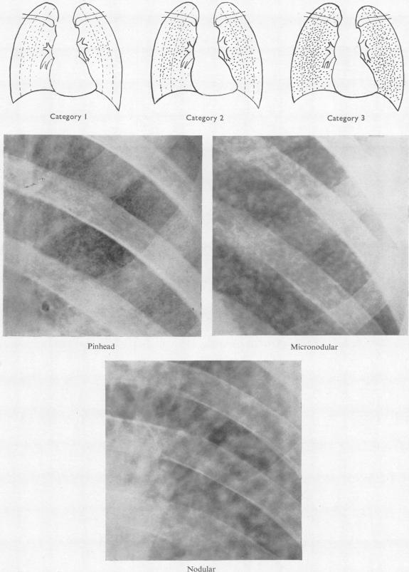 graphic file with name brjindmed00244-0057-a.jpg