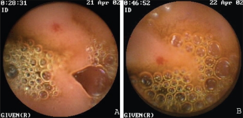 Figure 4)