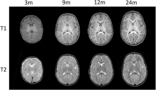 Fig. 3