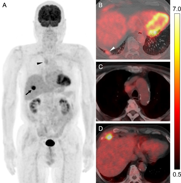 Fig 3