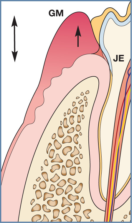 Figure 29